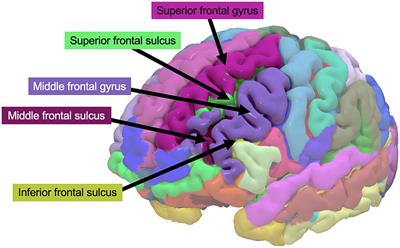 Lateral prefrontal cortex thickness is associated with stress but not cognitive fatigue in exhaustion disorder